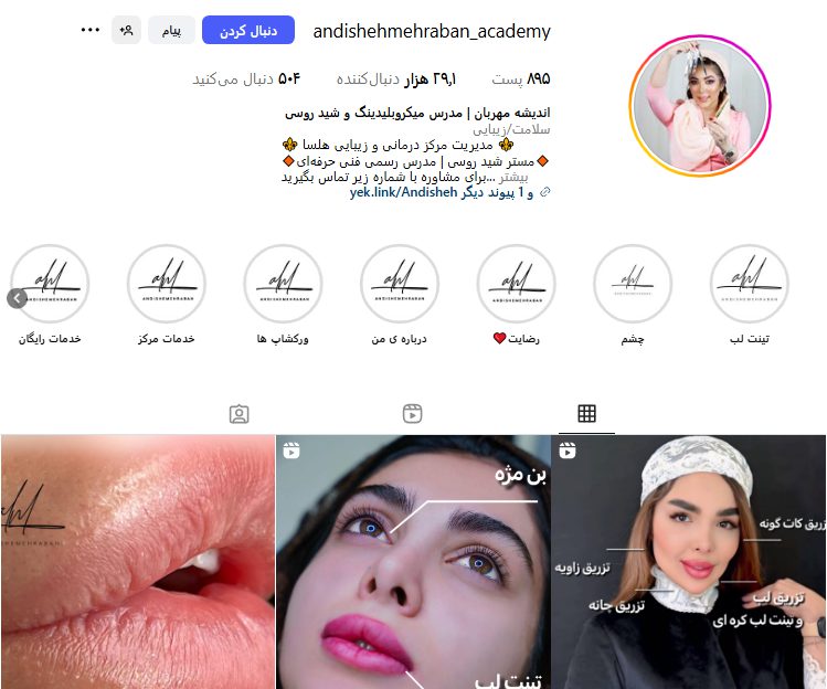 اندیشه مهربان؛ فیبروز ابرو در اصفهان