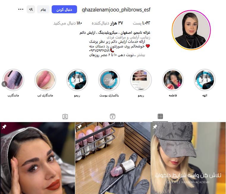 غزاله نامجو؛ میکروبلیدینگ در اصفهان