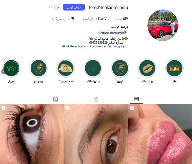 فرشته کریمی؛ میکروبلیدینگ ابرو در اصفهان