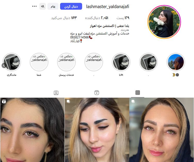 مرکز اکستنشن تخصصی یلدا نجفی