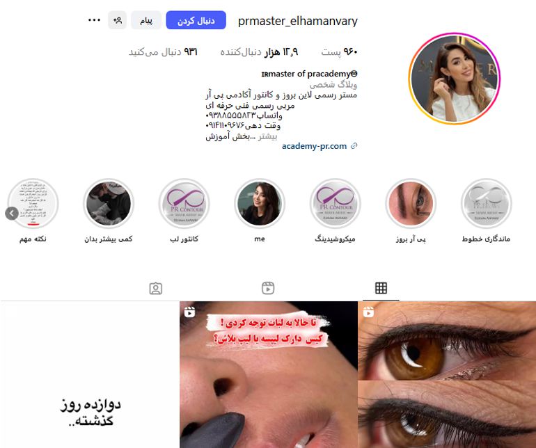 اکسیر الهام انوری میکروبلیدینگ کار