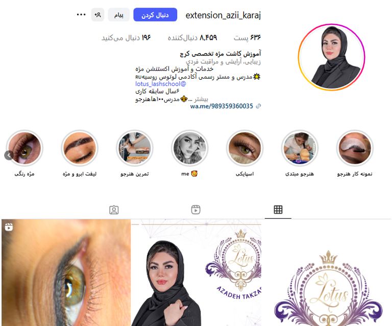 مرکز کاشت مژه آزاده تکزاره