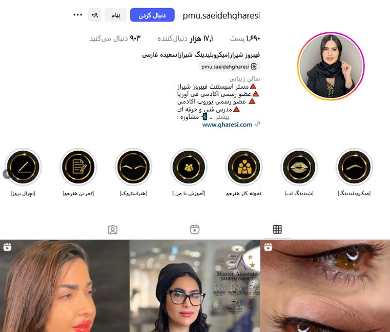 میکروبلیدینگ سعیده غارسی