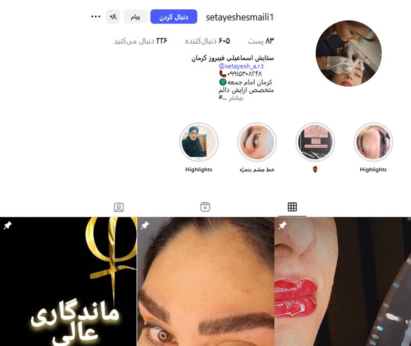 میکروبلیدینگ فیبروز کرمان (سالن سورنا)