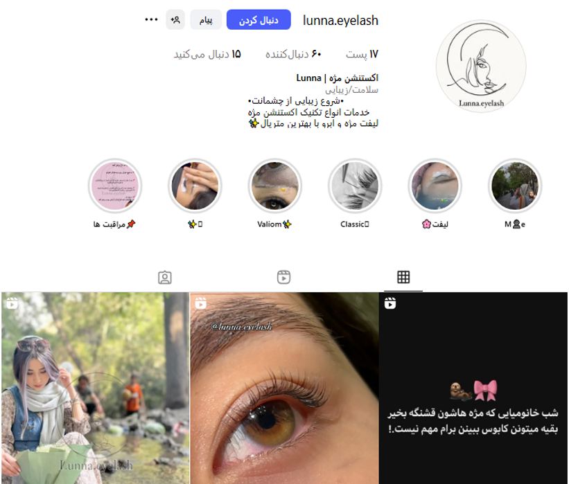 کاشت مژه هیدن