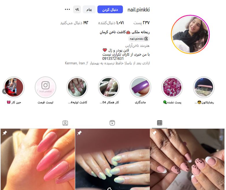 کاشت ناخن کرمان آزادی