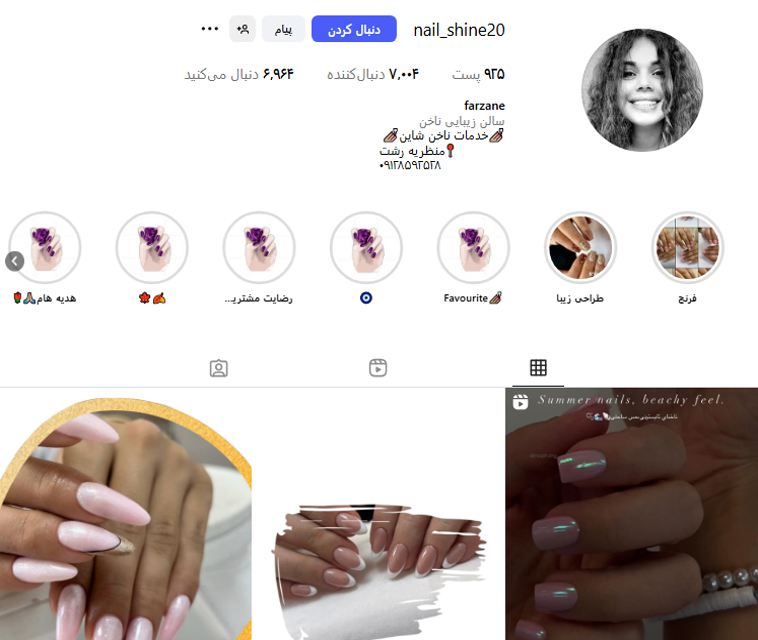 کاشت و ترمیم ناخن شاین