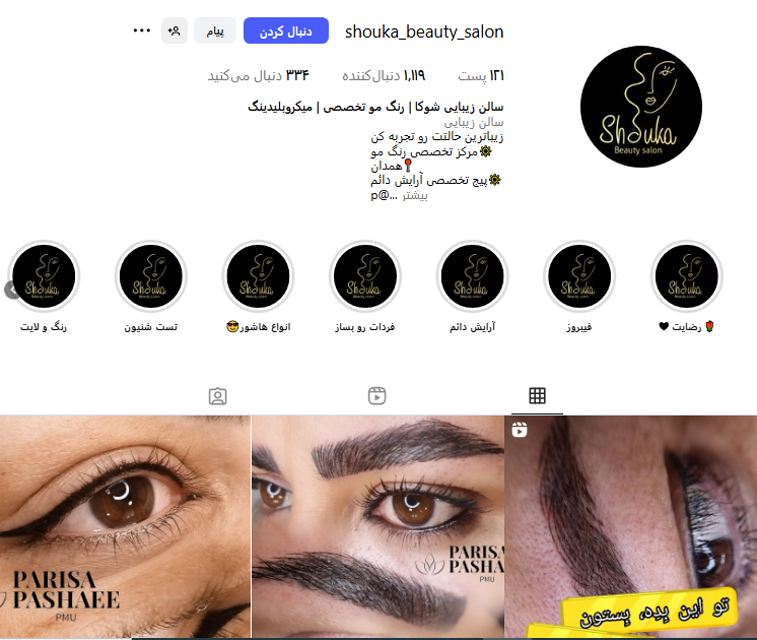 احیا و تراپی مو شوکا در همدان
