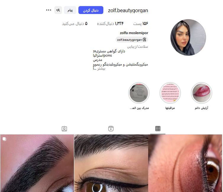 احیای مو زلف در گرگان