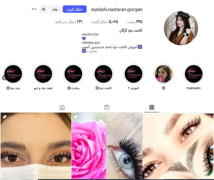 کاشت مژه نسترن