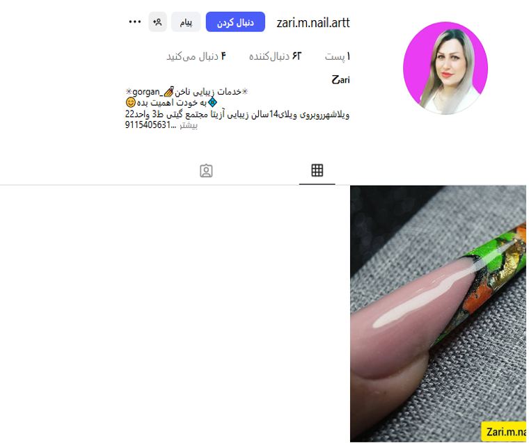 کاشت ناخن زهرا میر