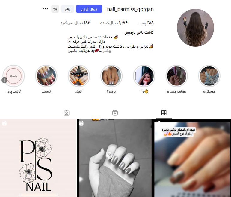 کاشت ناخن پارمیس