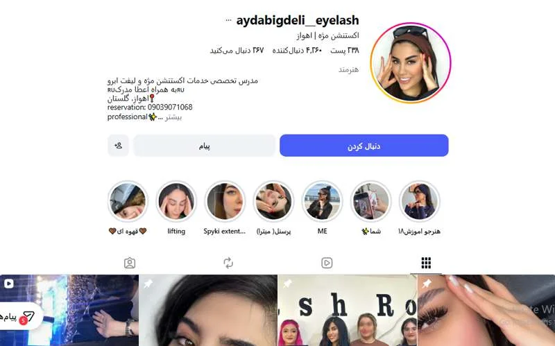کاشت مژه آیدا بیگدلی اهواز
