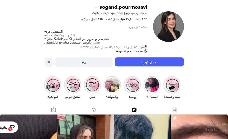 کاشت مژه سوگند پورموسوی اهواز