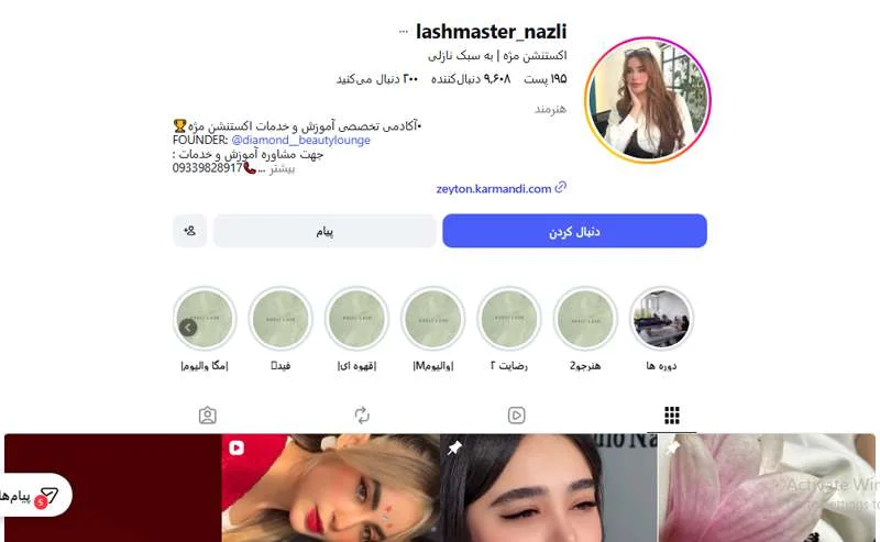 کاشت مژه نازلی اهواز