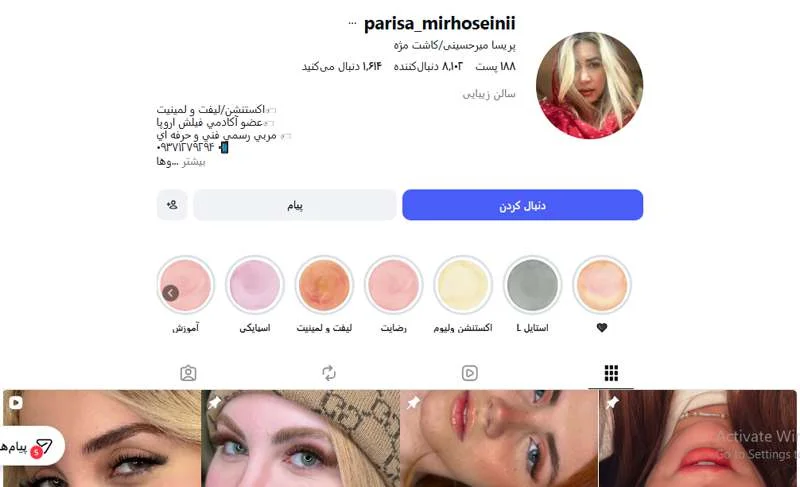 کاشت مژه پریسا میرحسینی اهواز