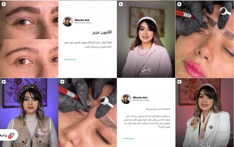 بهترین سالن فیبروز ابرو در کرج
