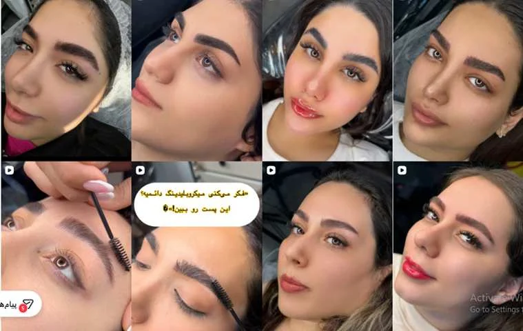 فیبروز ابرو در کرج