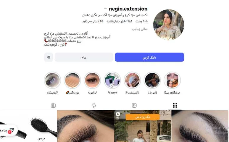 کاشت مژه نگین دهقان