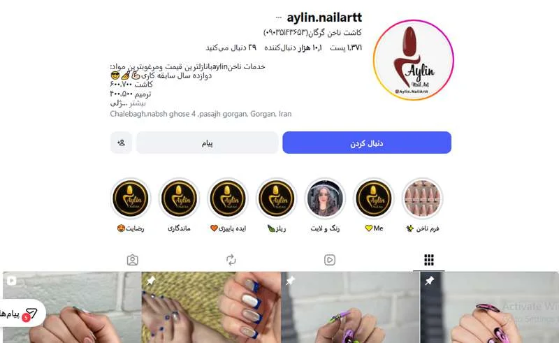 کاشت ناخن آیلین گرگان