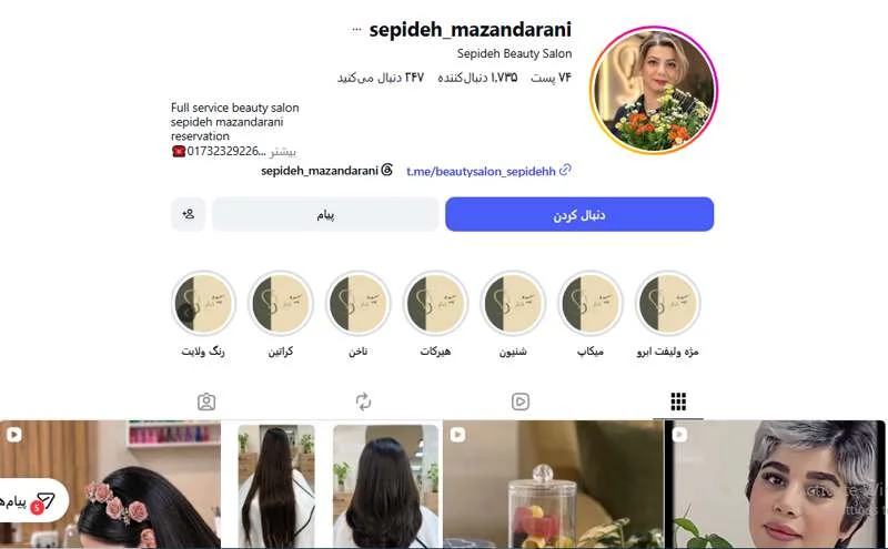 کاشت ناخن سپیده گرگان