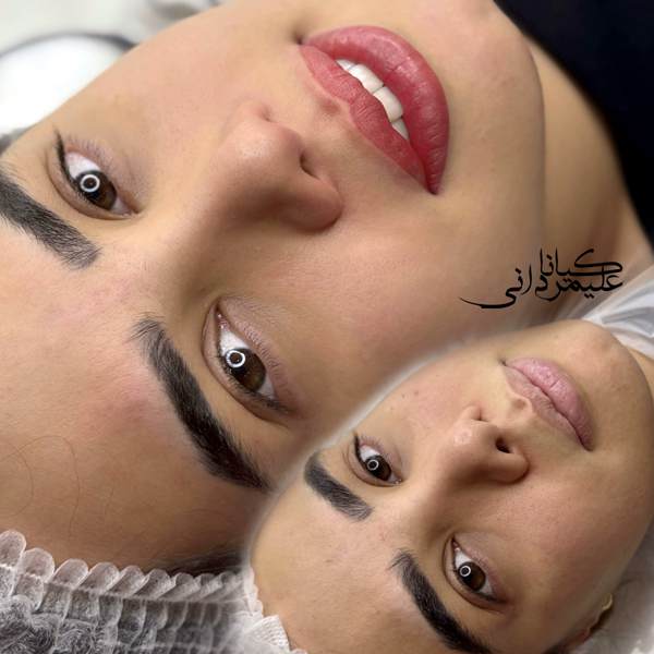 شیدینگ لب علیمردانی