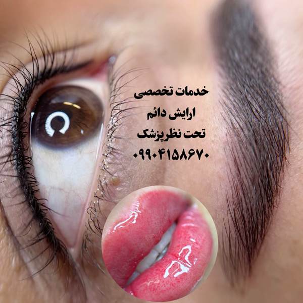 میکرو کیانا