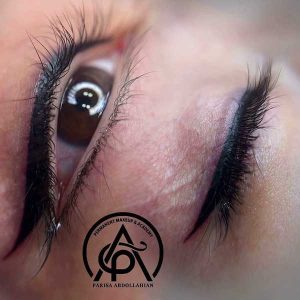 بهترین شیدینگ لب در مشهد