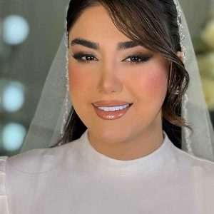 مژه بابل