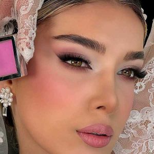 کاشت مژه بابل