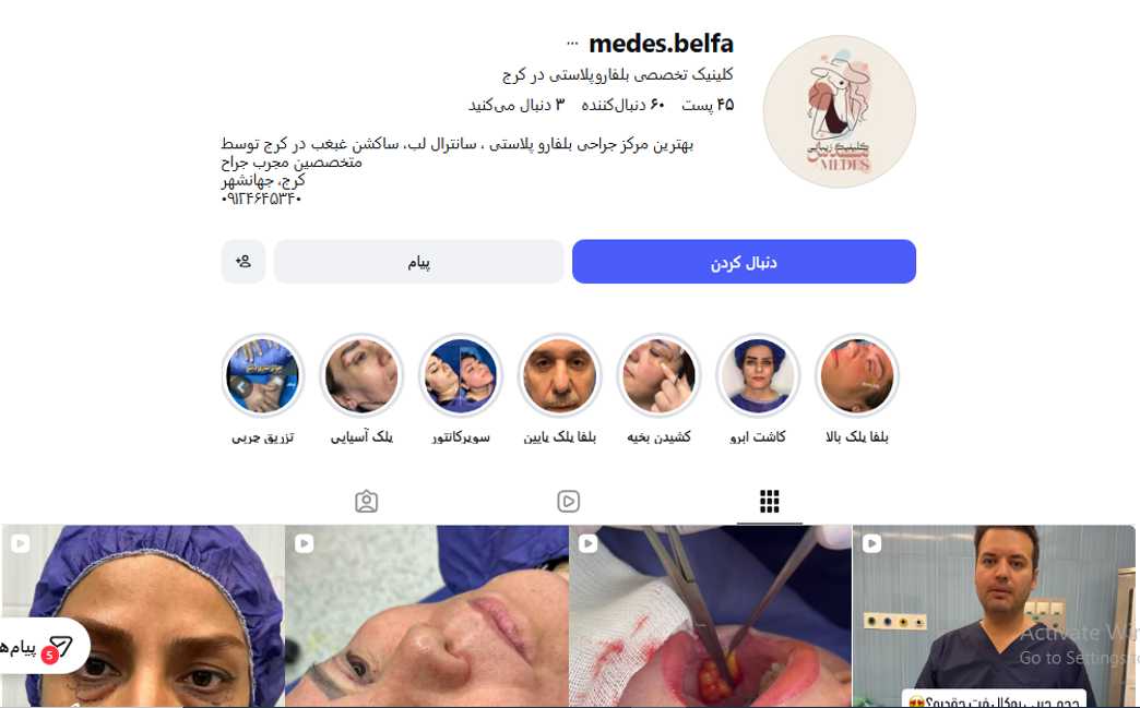 کلینیک تخصصی بلفاروپلاستی در کرج